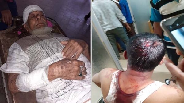 ড্রেইনের পাইপ বসানোকে কেন্দ্র করে  দক্ষিণ সুরমায় প্রতিপক্ষের হামলা, আহত ৩