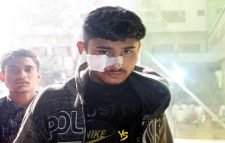 দক্ষিণ সুরমায় সি এন জি দুঘর্টনায় আহত ২