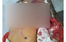 মদিনা মার্কেটে এক চালককে পিষে মারল আরেক অটোরিকশা চালক