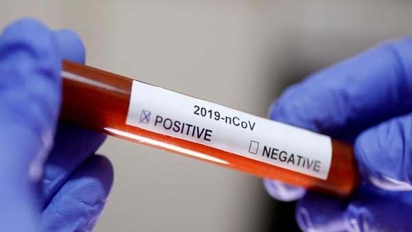 বিশ্বজুড়ে কমেছে মহামারী’