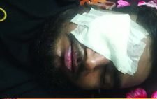 সার্কিট হাউসের সামনে পরিবহণ শ্রমিকদের হামলায় দুই সহোদর আহত