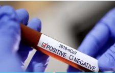 একদিনে সিলেটে ৪৩ জন শনাক্ত