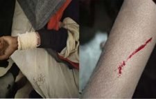 বড়লেখায় স্বামীর সঙ্গে বিরোধে স্ত্রীর ওপর হামলা