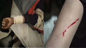 বড়লেখায় স্বামীর সঙ্গে বিরোধে স্ত্রীর ওপর হামলা