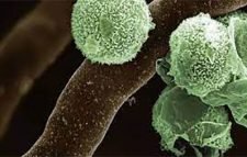 এবার নতুন উদ্বেগের নাম গ্রিন ফাঙ্গাস..