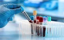 দেশে মানুষের দেহে অ্যান্টিবডি শনাক্ত