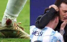 রক্তঝরা পা নিয়ে দুর্দান্ত পারফর্ম, মেসির প্রশংসায় কোচ