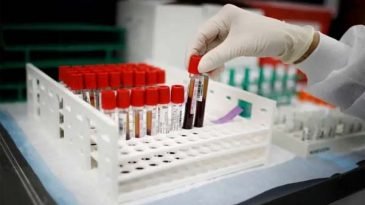 আগস্টের শুরুতে ১ কোটি ১০ লাখ টিকা আসছে