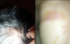 রাজধানীতে হামলার শিকার সাংবাদিক