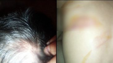 রাজধানীতে হামলার শিকার সাংবাদিক