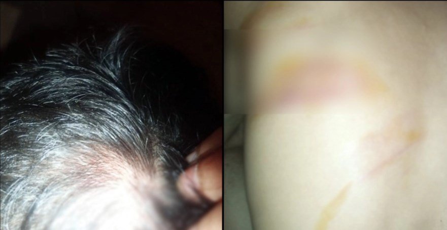 রাজধানীতে হামলার শিকার সাংবাদিক