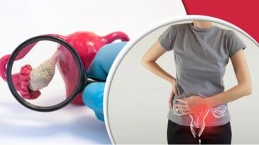 নারীর ডিম্বাশয়ে ক্যানসারের যেসব লক্ষণ