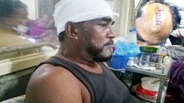 সিলেটের এয়ারপোর্টে সৎ ভাইয়ের দায়ের কুপে আহত আরেক ভাই