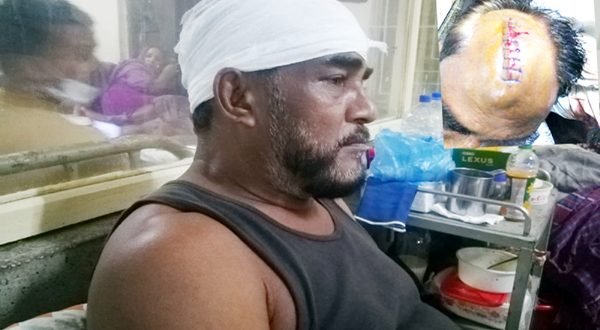 সিলেটের এয়ারপোর্টে সৎ ভাইয়ের দায়ের কুপে আহত আরেক ভাই