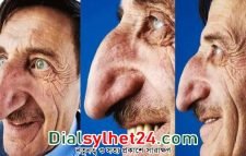 বিশ্বের সবচেয়ে লম্বা নাকের অধিকারী মেহমেত আর নেই