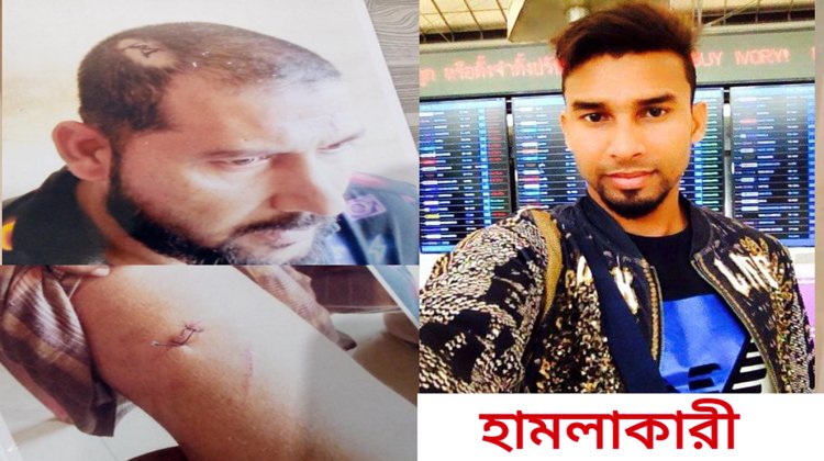 নির্জনস্থানে কুপিয়ে প্রাণে হত্যার চেষ্টায় পারভেজ মিয়া আহত