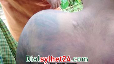 দুই বাংলাদেশীকে পিটিয়ে সীমান্তে ফেলে গেল বিএসএফ