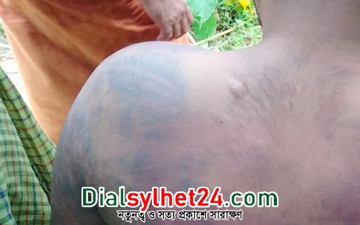 দুই বাংলাদেশীকে পিটিয়ে সীমান্তে ফেলে গেল বিএসএফ