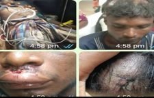 রাজনগরে প্রতিপক্ষের হামলা- আহত-৪