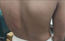 কুলাউড়া আহমদাবাদ মাদ্রাসায় শিক্ষার্থীকে অমানবিক নির্যাতন