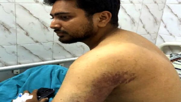 আমাকে শারীরিক ও মানসিক টর্চার করে, একপর্যায়ে অজ্ঞান হারিয়ে ফেলি – নাহিদ ইসলাম